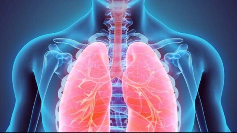 چه کسانی بیشتر در برابر آلودگی هوا آسیب‌پذیرتر هستند؟_692f26ffa56d1.jpeg